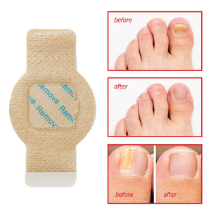 Nail Renewal Over Night Treatment Patches Hydrogel Nail Care 21 pcs