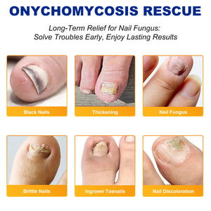 OverNight Renewal Nail Treatment Patches Hydrogel Nail Care 32 pcs