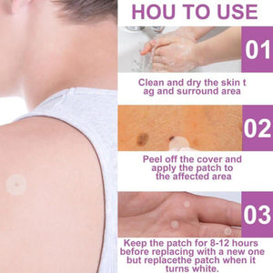 Boxania® 144 pcs Invisible Skin Tag,Acne and Wart Remover Patches Set with Natural Ingredients Safe and Effective Pimple Acne Remover Skin Care