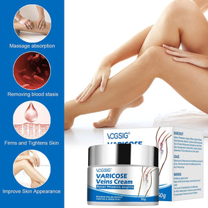 Boxania® Varicose Veins Cream, Soothing Leg with Natural Ingredients, Improves Blood Circulation of Spider Veins, Improve Pain of Legs - 50g