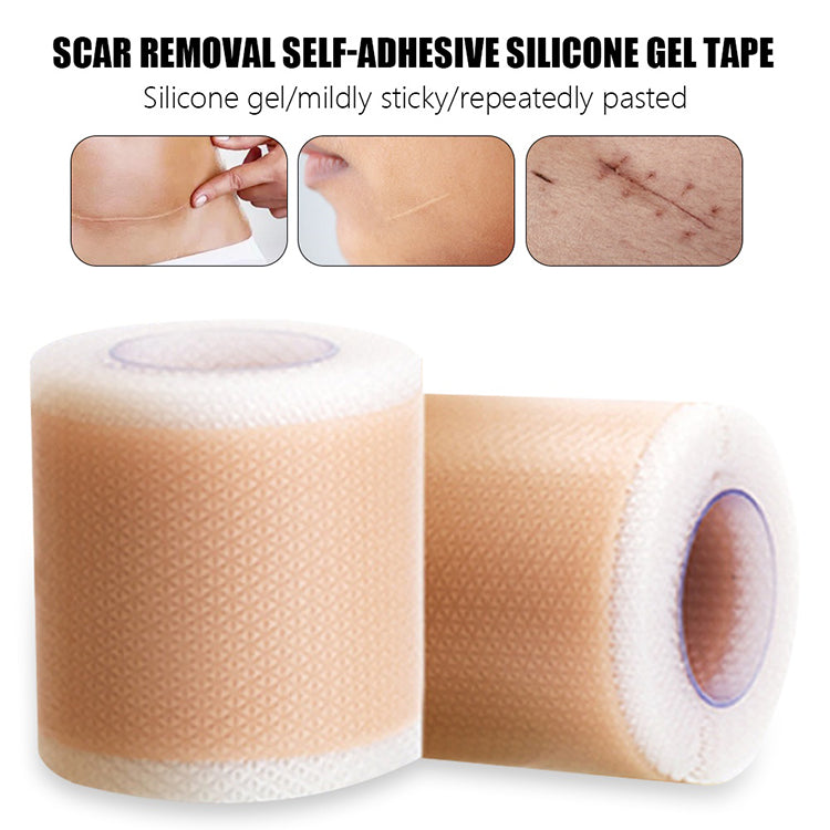 Patcheal Medical Soft Silicone Gel Tape for Scar Removal, Tear Silicone  Tape Roll, For Hypertrophic Scars and Keloids Caused by Surgery, Pain-Free